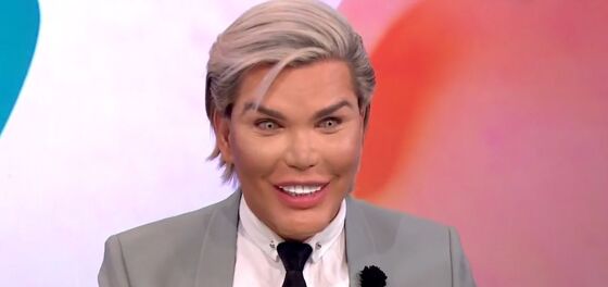 “Human Ken Doll” abandons cosmetic surgery for a new obsession