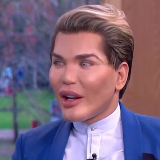 “Human Ken Doll” says he was drugged, robbed, and had his teeth smashed out