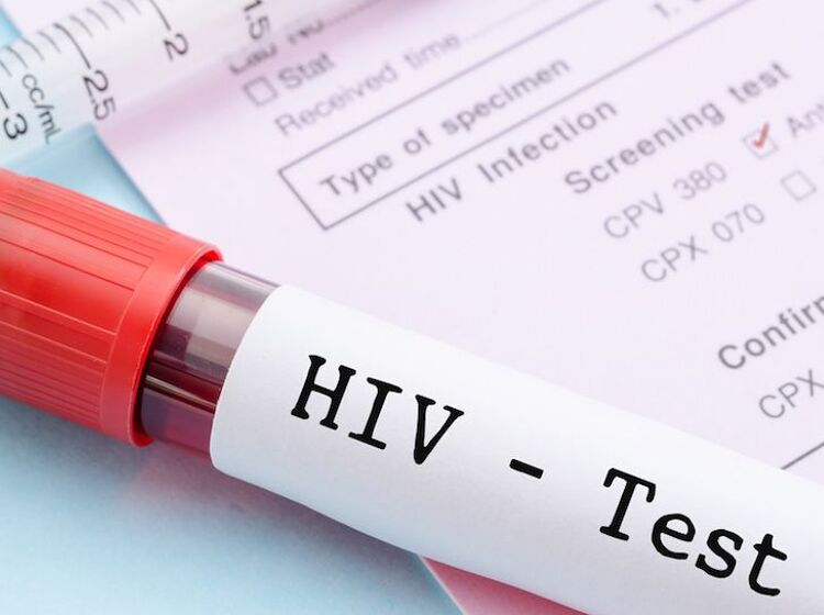 Man awarded $18.4 million after doctors completely botched his HIV test