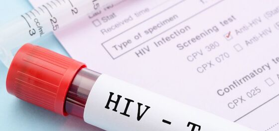 Dramatic drop in HIV infections among gay men in the UK