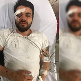 Gay rugby player hospitalized after “brutal homophobic attack”