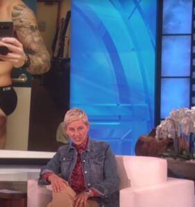Gus Kenworthy shows Ellen his battle wounds, but nobody’s looking at the bruise