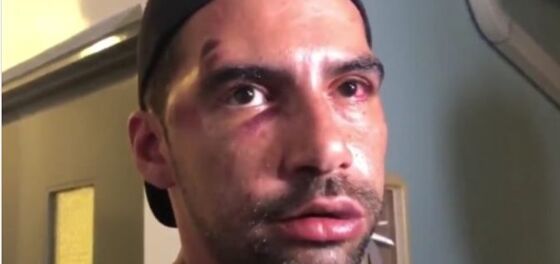 Disturbing video captures gay couple being violently attacked at Miami Beach Pride
