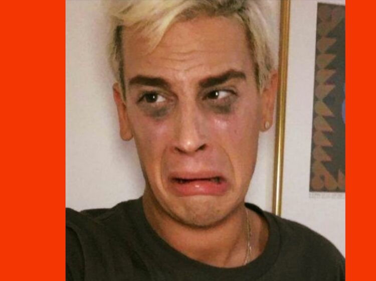 Milo Yiannopoulos’ financial horror show just got much, much worse