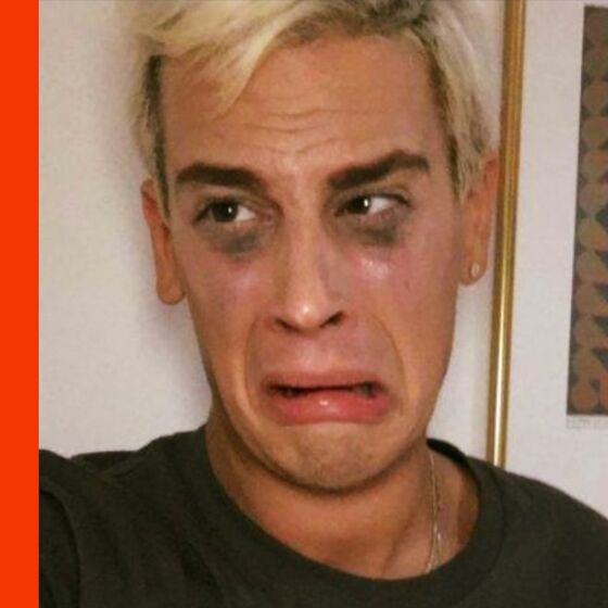 Milo Yiannopoulos’ financial horror show just got much, much worse