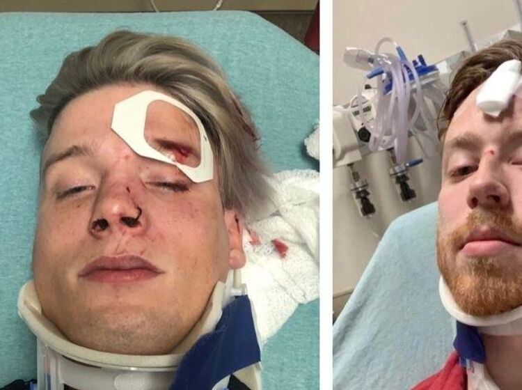 Police arrest 22-year-old suspect in connection with attack on Austin gay couple