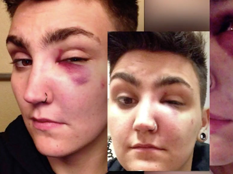 Several men attacked this trans guy in front of his home for "acting gay"