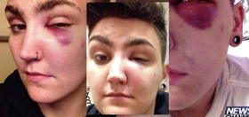 Several men attacked this trans guy in front of his home for “acting gay”