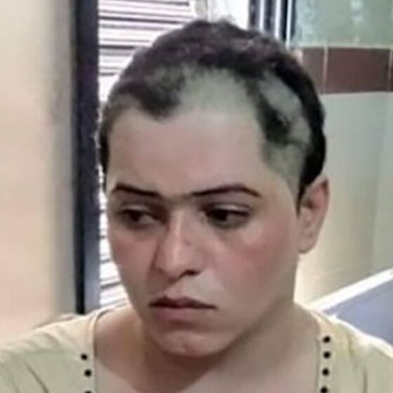 A gang kidnapped, blackmailed, tortured and shaved off this trans woman's hair