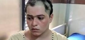 A gang kidnapped, blackmailed, tortured and shaved off this trans woman’s hair