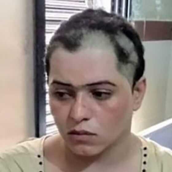 A gang kidnapped, blackmailed, tortured and shaved off this trans woman’s hair