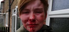 Lesbian teen beaten bloody by “friends” over a matter of $12
