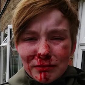Lesbian teen beaten bloody by “friends” over a matter of $12