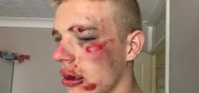 Man viciously attacked near a McDonald’s after standing up to homophobic taunts