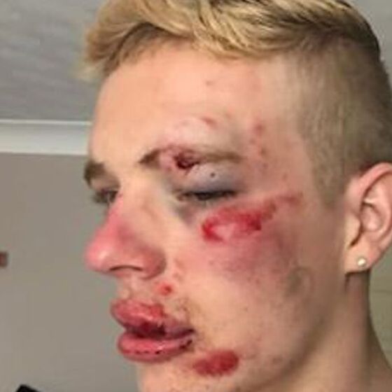 Man viciously attacked near a McDonald’s after standing up to homophobic taunts