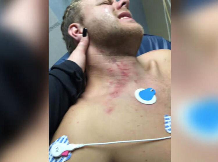 North Carolina gay couple beaten by police impersonators