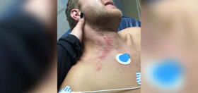 North Carolina gay couple beaten by police impersonators