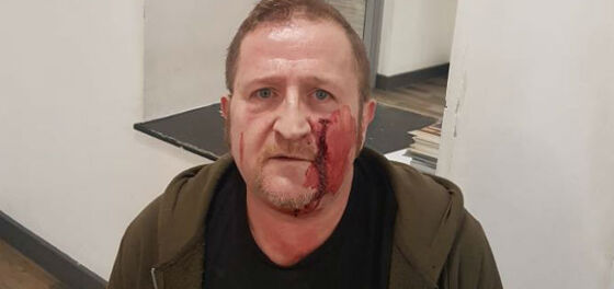 Man attacked by youths with hammers when he turns up for Grindr date
