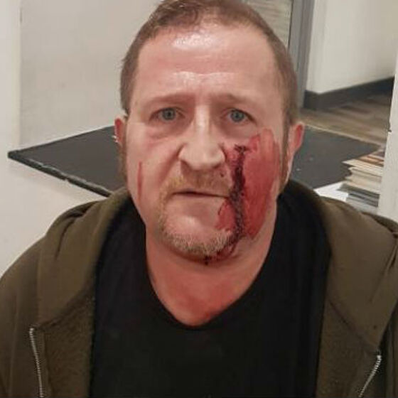 Man attacked by youths with hammers when he turns up for Grindr date