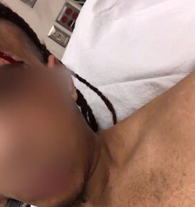 Man beaten with shovel, slashed with box cutter in alleged antigay hate crime
