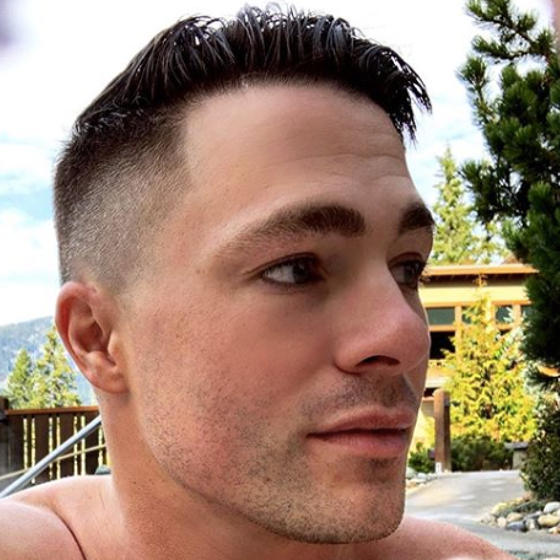 Colton Haynes loses an arm on the set of ‘Arrow’
