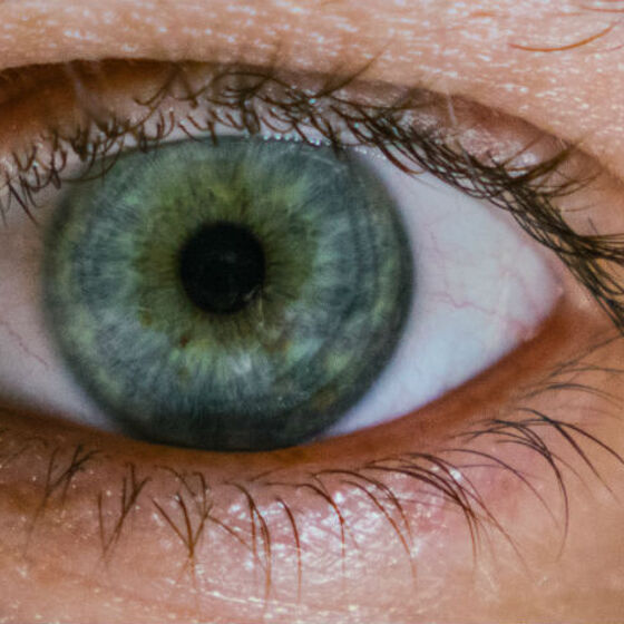Man diagnosed with rare case of syphilis in both eyes