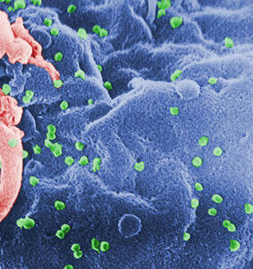 Scientists can’t find any trace of HIV in man potentially “cured” via medication alone