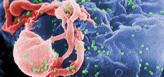 Major HIV vaccine trial abandoned because the vaccine doesn’t work