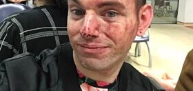 Man lands in hospital defending friends under homophobic attack