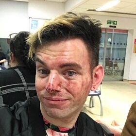 Man lands in hospital defending friends under homophobic attack