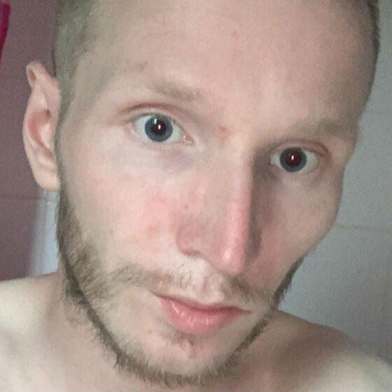 Scottish man, 25, dies of AIDS-related illness after late HIV diagnosis