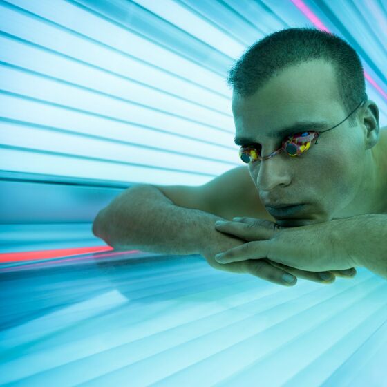 Gay men’s skin cancer risk may be more complicated than tanning beds