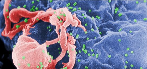 This is how the world first learned about AIDS 40 years ago today