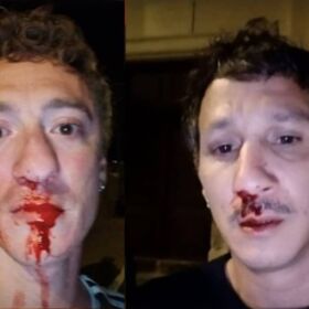 Vacationing gay couple beaten and jeered at by mob in Corsica