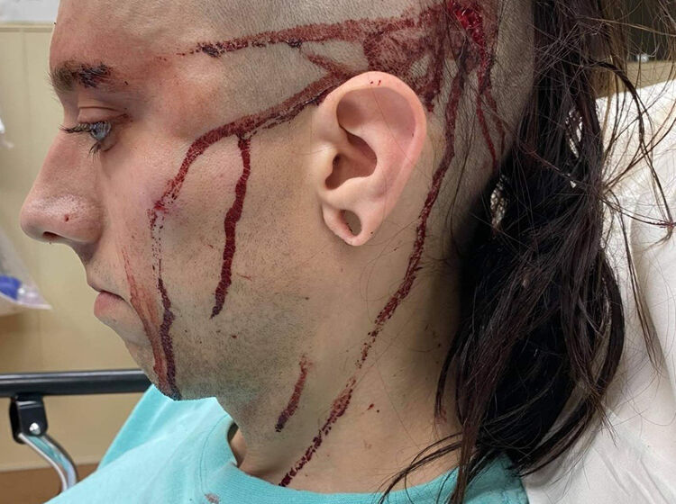 Wyoming trans woman hospitalized following brutal public beating