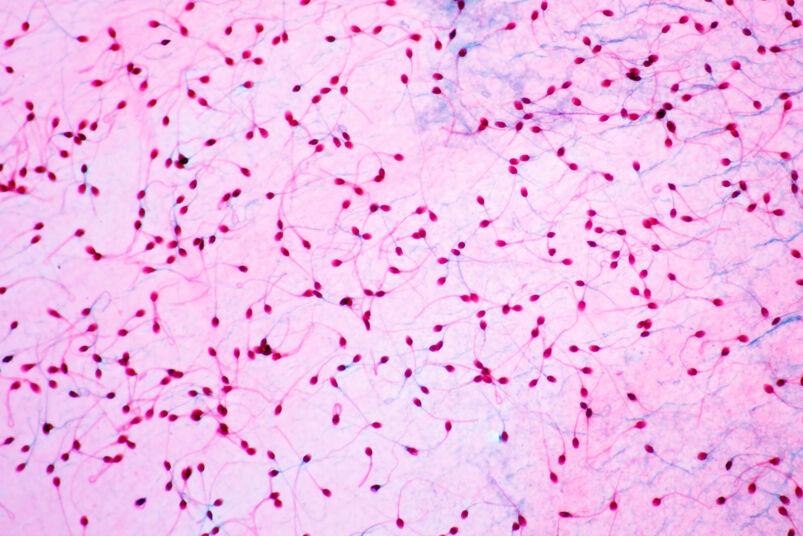 Facts about semen: Sperm viewed under a microscope