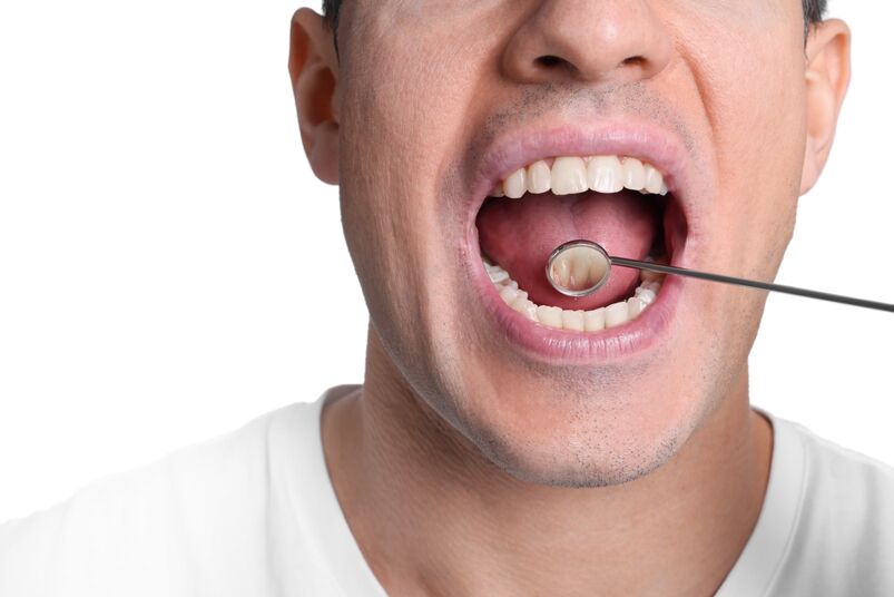 Examining man's teeth and gums with mirror on white background for HPV oral cancer closeup
