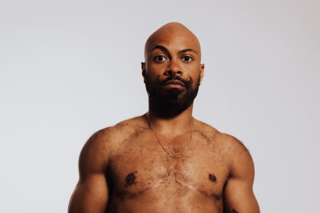 Acrobat Toni Cannon talks joining the circus, finding love on the apps & 10-day meditation retreats - Vimarsana News